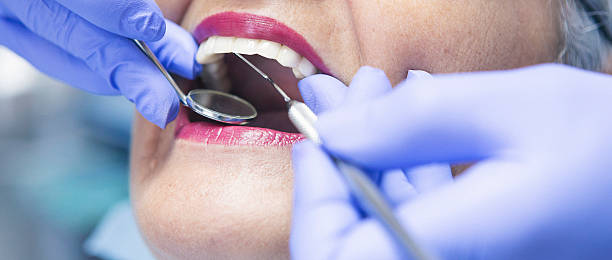 Best Urgent Care for Lost Fillings or Crowns in Mount Shasta, CA